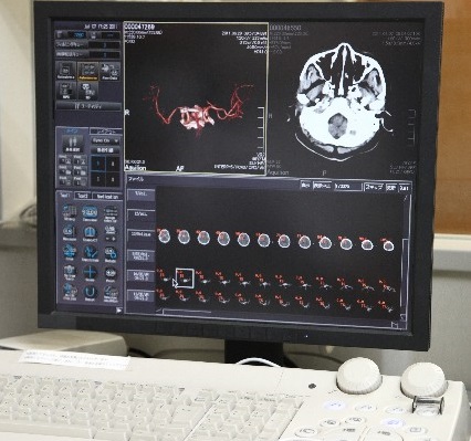 脳画像